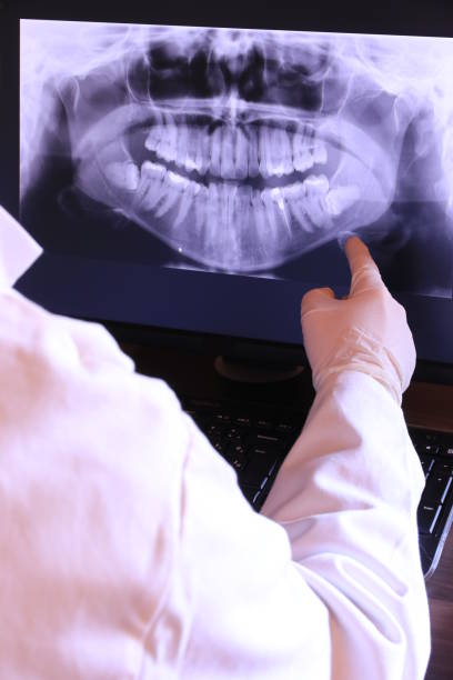 Best Emergency Treatment for Dental Infections or Abscesses in Fairfield Harbour, NC